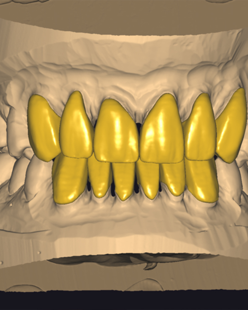 Imagen Expertos en Prótesis Dentales desde 1990