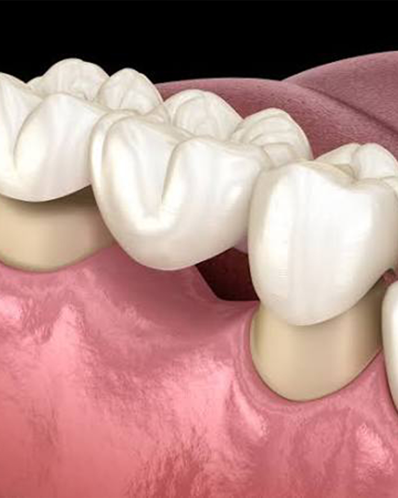 Imagen 3 Expertos en Prótesis Dentales desde 1990
