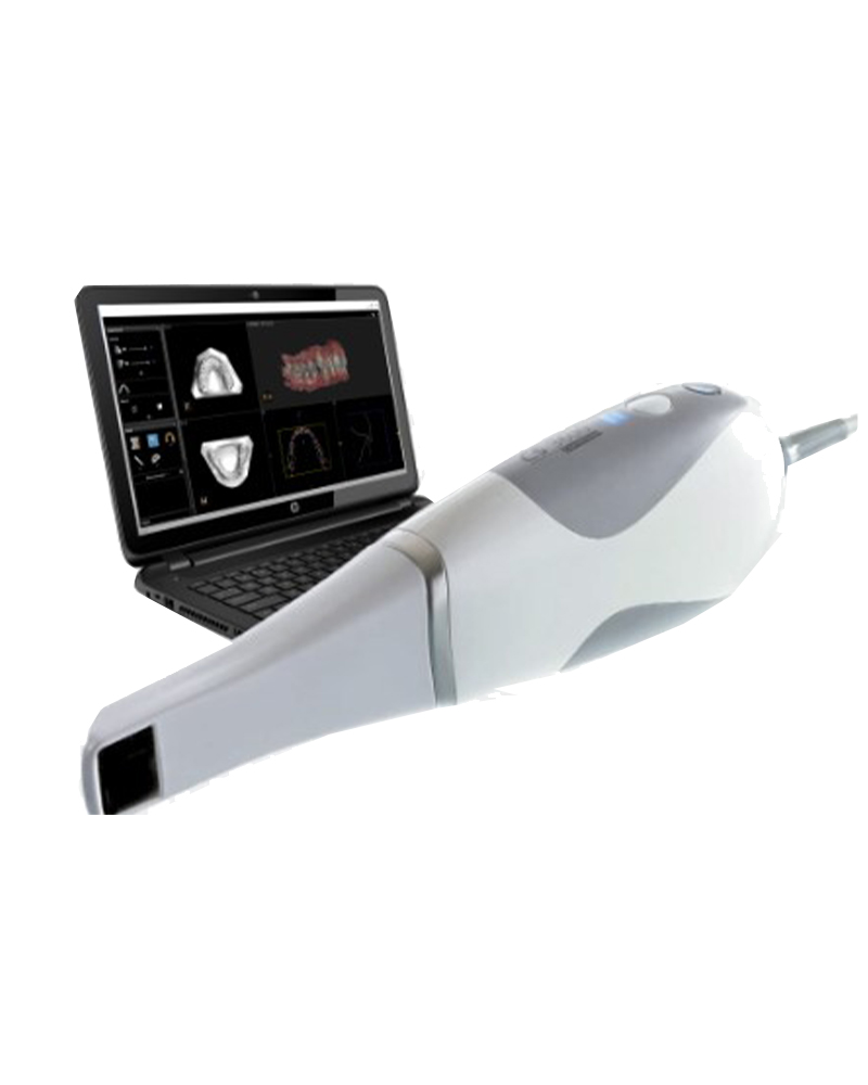 Imagen ESCANEADO INTRAORAL